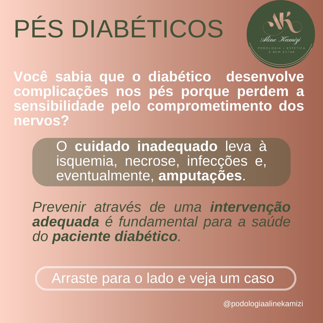 Ilustração informativa sobre cuidados com pés diabéticos
