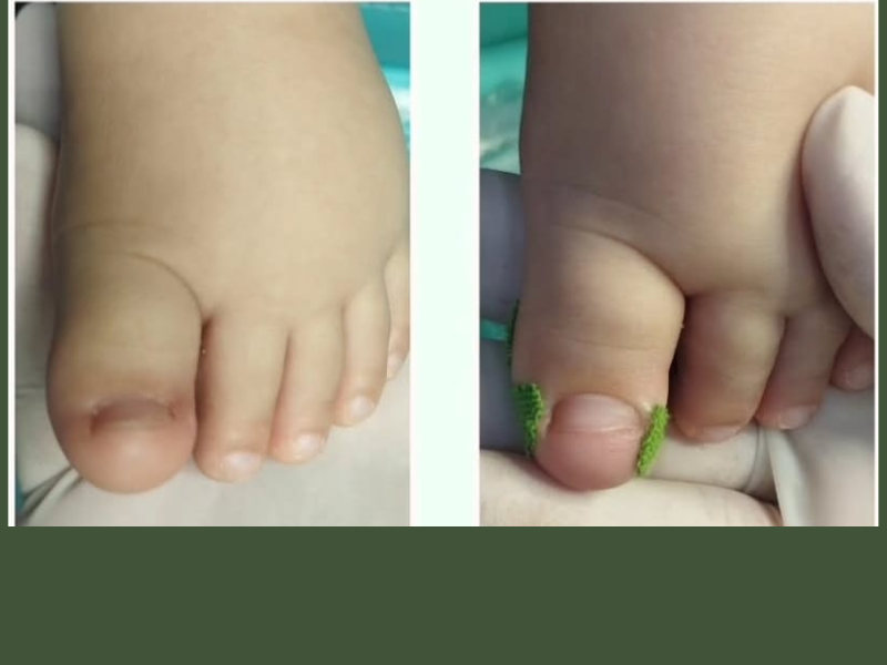 Atendimento de podopediatria com criança